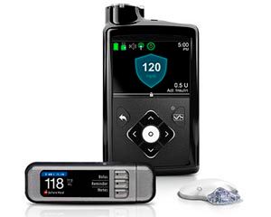 El primer páncres artificial es el nodelo 670G de Medtronic