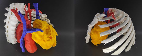 Dos prototipos del proyecto de impresión en 3D.