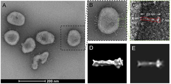 Imagen ampliada del nuevo coronavirus SARS-CoV2.