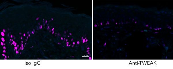 Captura de cómo la proliferación de células de la piel, como se ve en la psoriasis (indicada con tinción púrpura), disminuyó cuando se bloqueó la actividad TWEAK. 