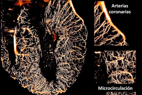 Microcirculación coronaria.